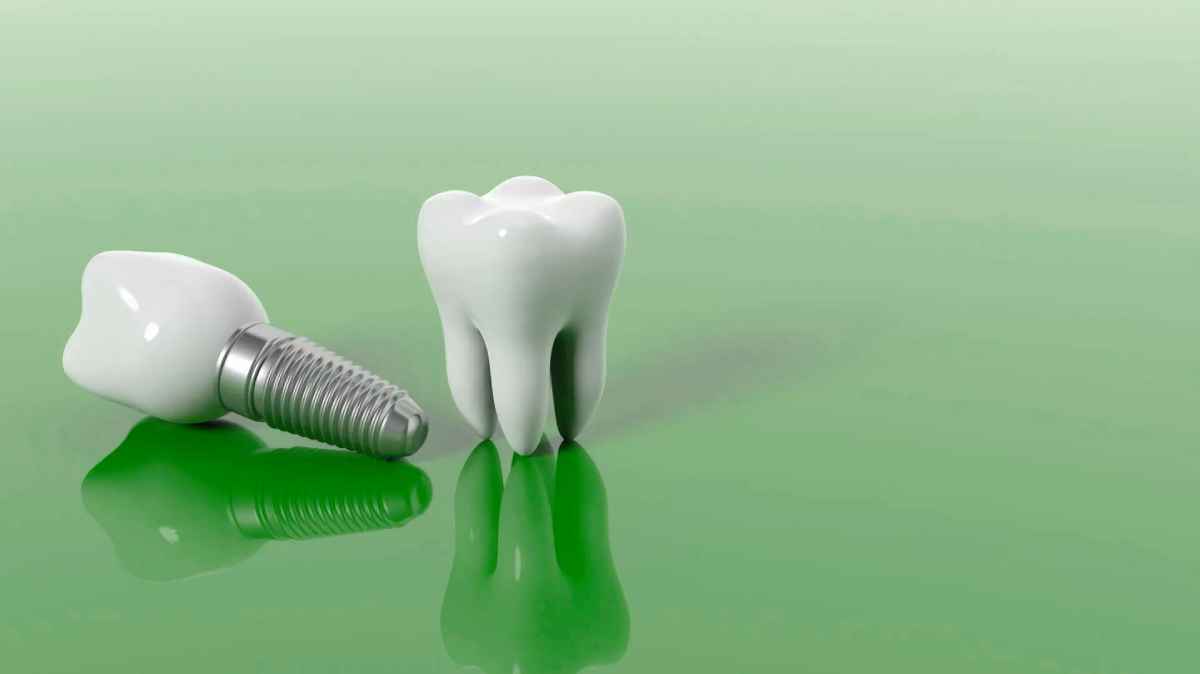 Why No Dairy After Dental Implant? Social Overdoze